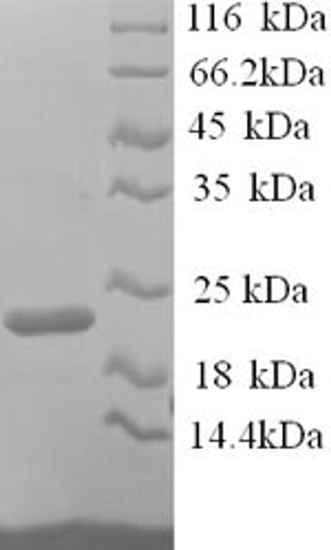 (Tris-Glycine gel) Discontinuous SDS-PAGE (reduced) with 5% enrichment gel and 15% separation gel.