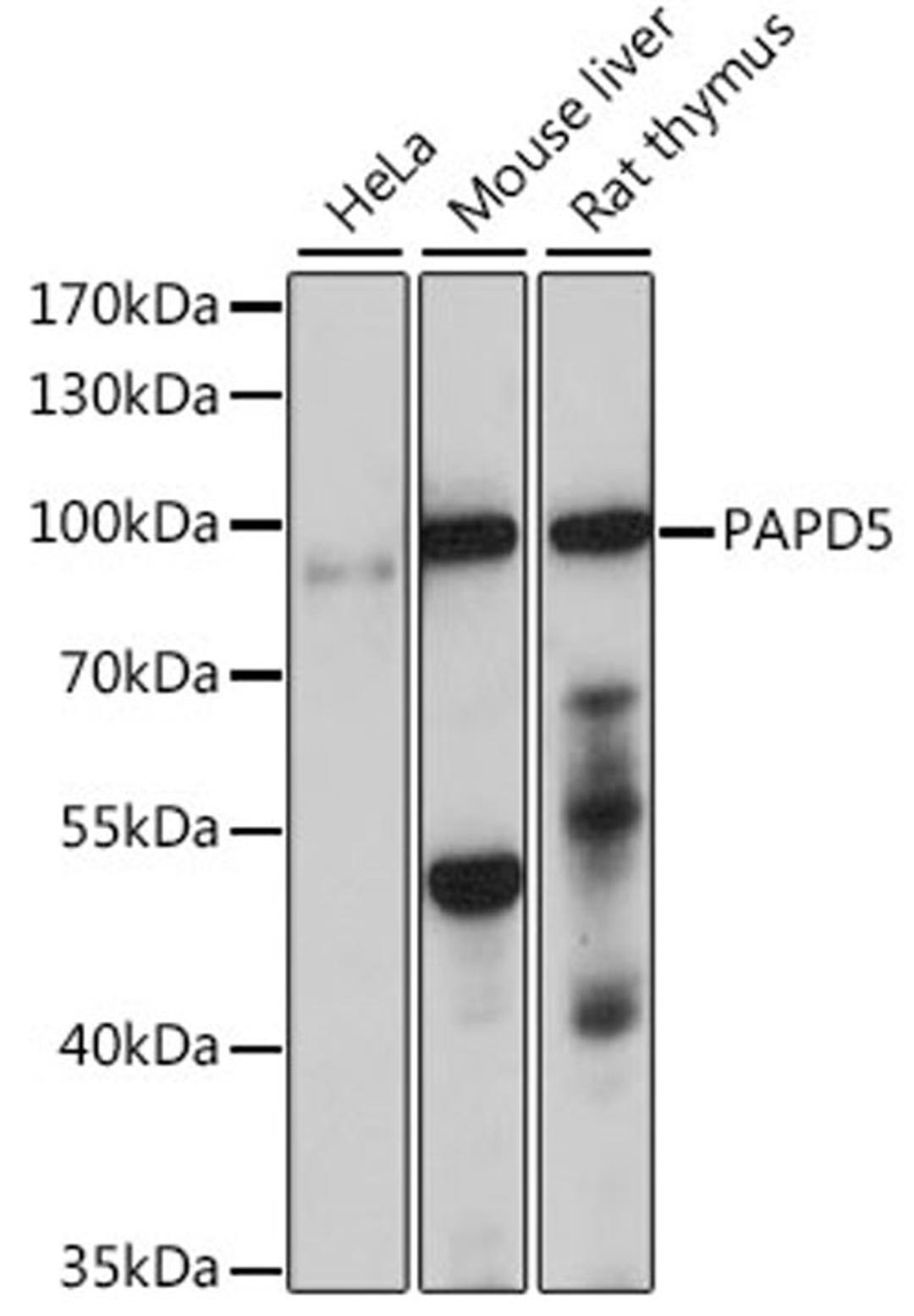 Western blot - PAPD5 antibody (A15885)