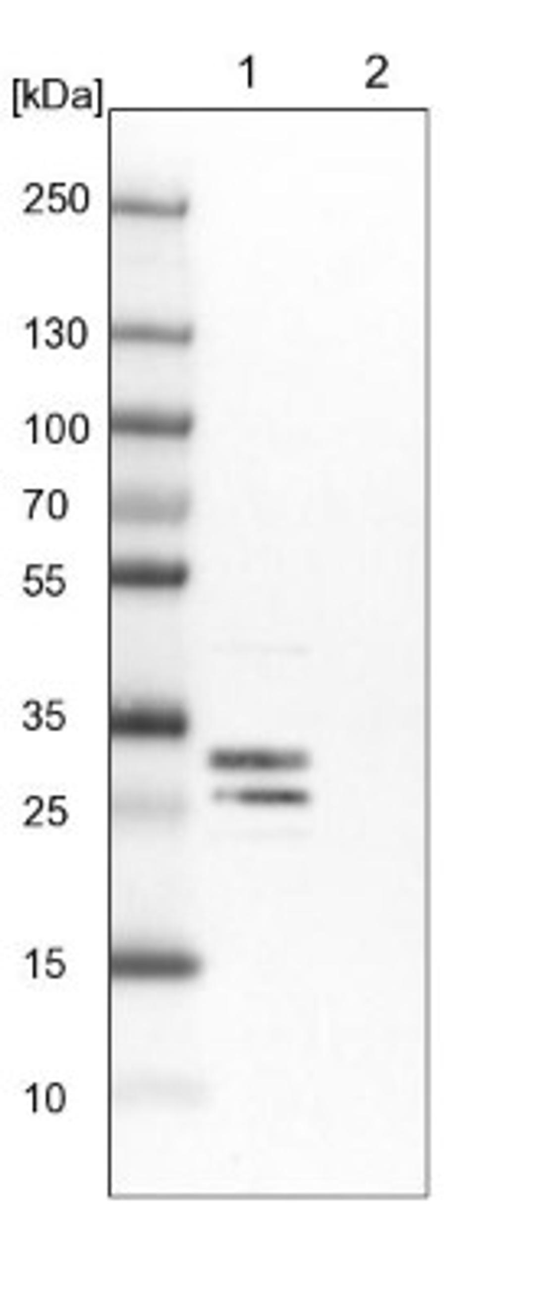 Western Blot: FKBP7 Antibody [NBP1-83889] - Lane 1: NIH-3T3 cell lysate (Mouse embryonic fibroblast cells)<br/>Lane 2: NBT-II cell lysate (Rat Wistar bladder tumour cells)