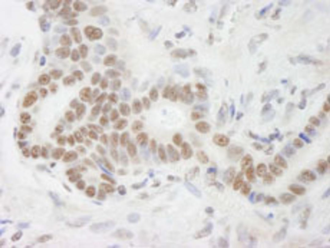 Detection of human DHX9 by immunohistochemistry.