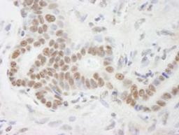 Detection of human DHX9 by immunohistochemistry.