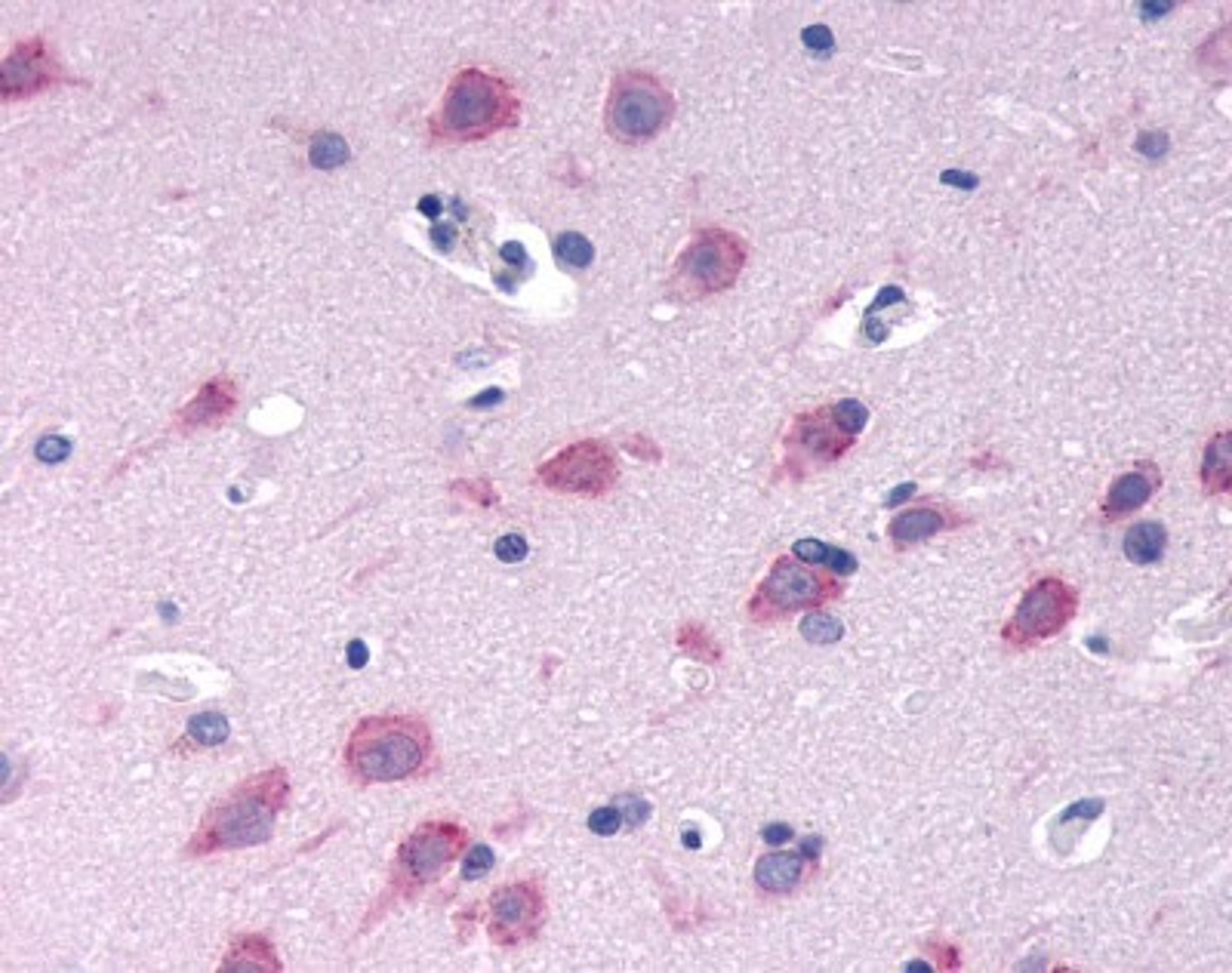 Immunohistochemistry-Paraffin: GPRC6A Antibody [NLS2576] - Analysis of anti-GPRC6A antibody with human brain, neurons and glia.