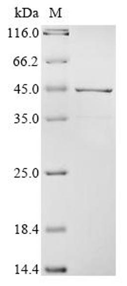 (Tris-Glycine gel) Discontinuous SDS-PAGE (reduced) with 5% enrichment gel and 15% separation gel.