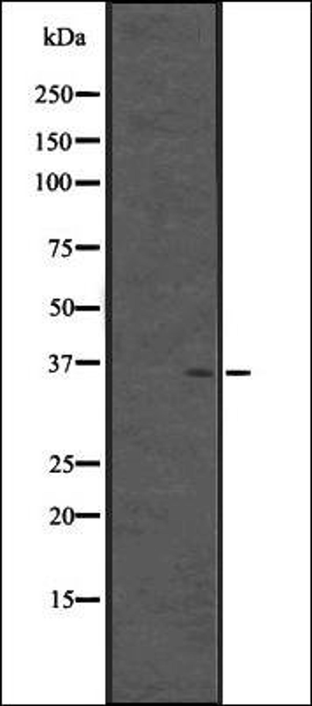 Western blot analysis of Fetal brain lysate -Human- using CPXCR1 antibody