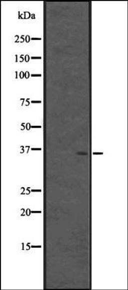 Western blot analysis of Fetal brain lysate -Human- using CPXCR1 antibody