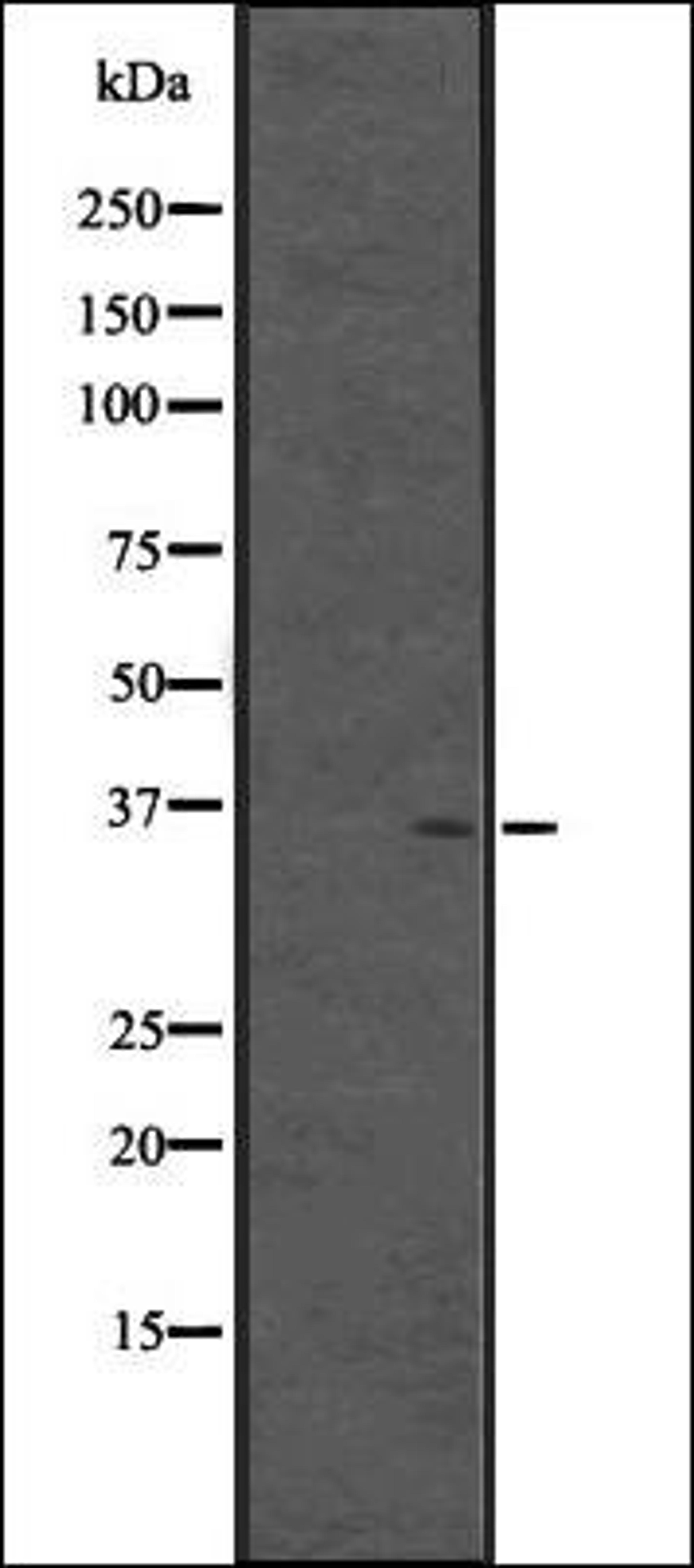 Western blot analysis of Fetal brain lysate -Human- using CPXCR1 antibody