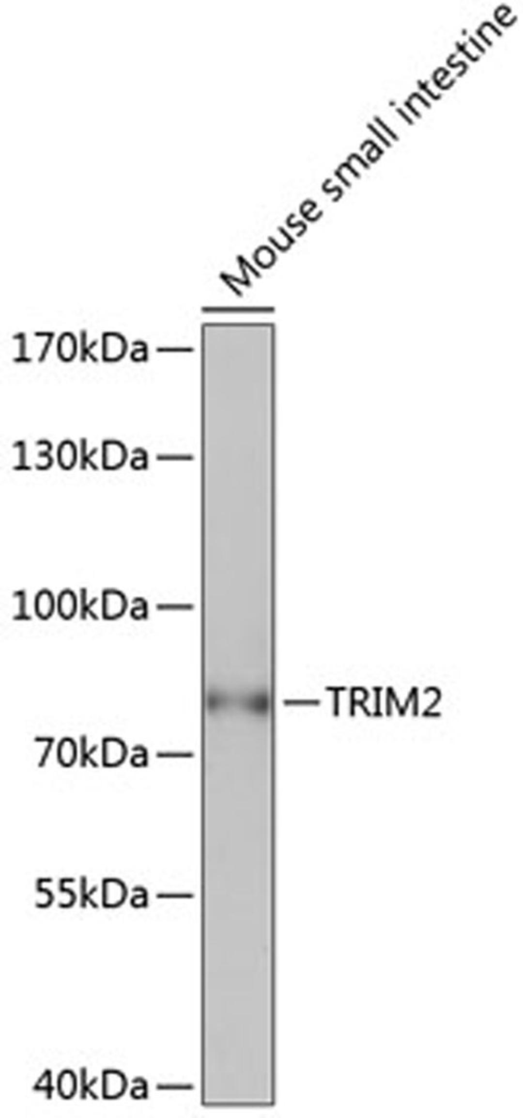 Western blot - TRIM2 antibody (A14393)