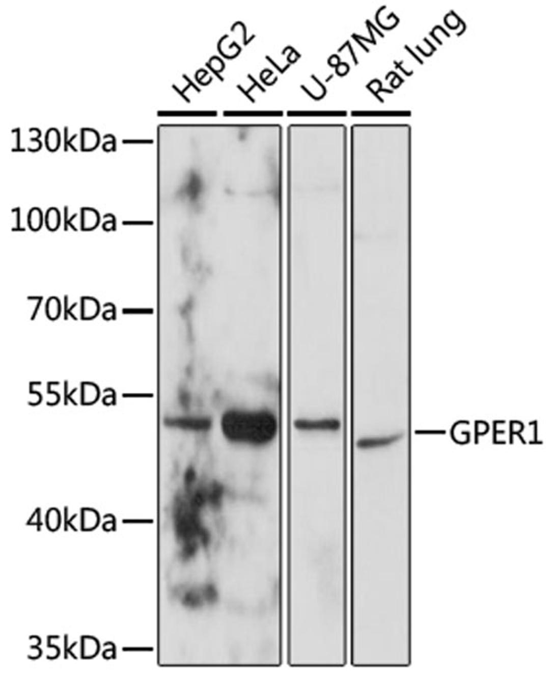 Western blot - GPER1 antibody (A10217)