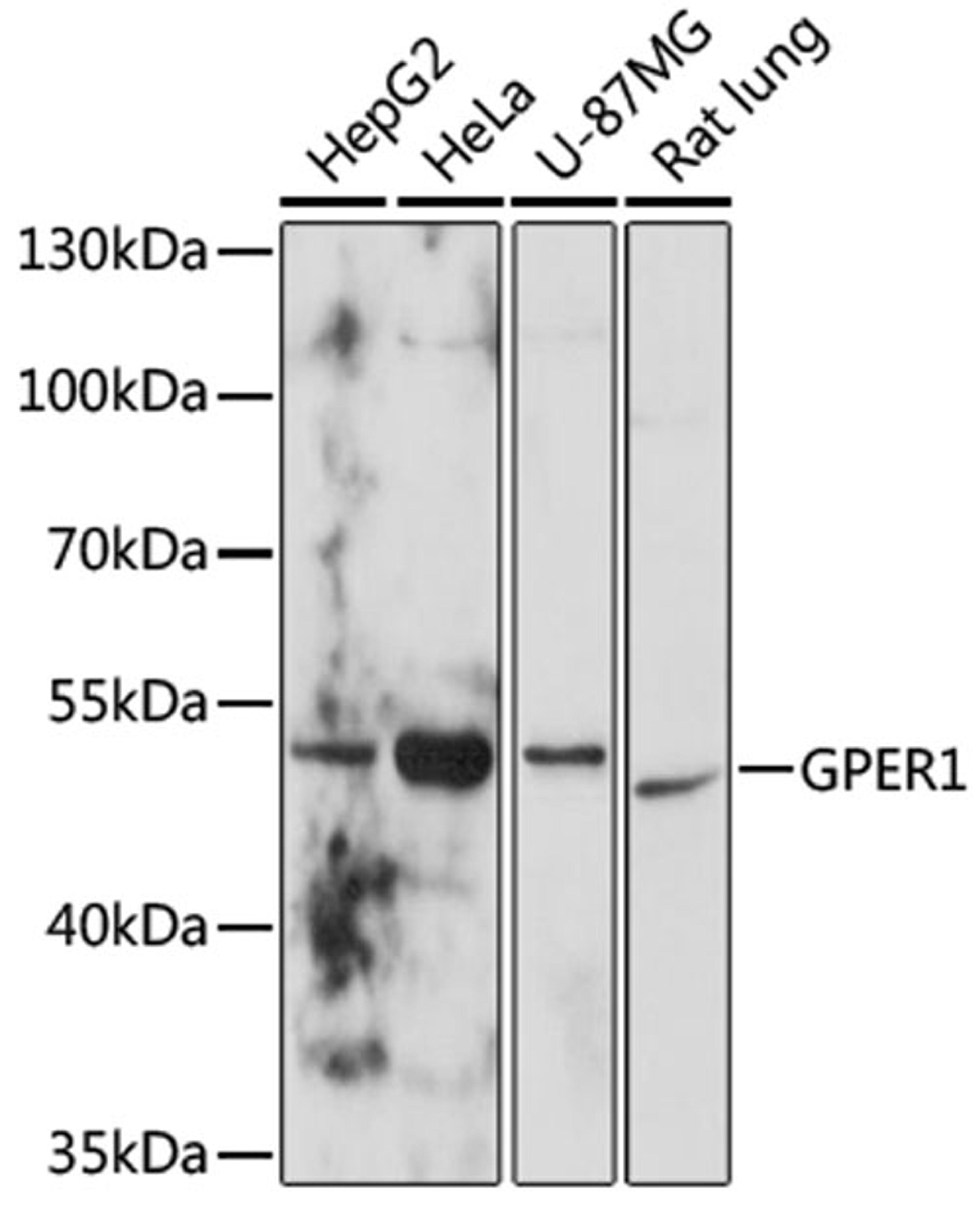 Western blot - GPER1 antibody (A10217)