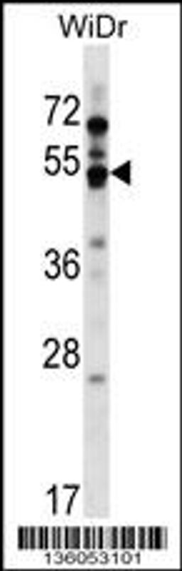 Western blot analysis in WiDr cell line lysates (35ug/lane).