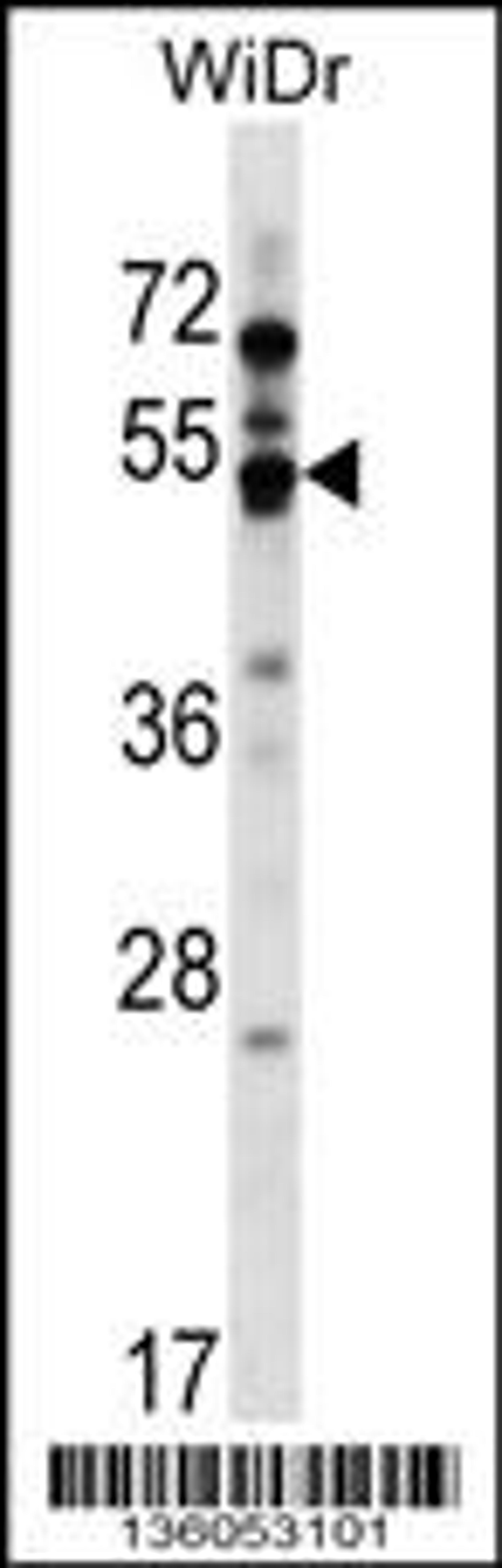 Western blot analysis in WiDr cell line lysates (35ug/lane).