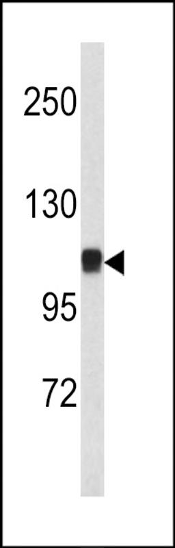 Western blot analysis of CTNA1 antibody in mouse bladder tissue lysates (35ug/lane)