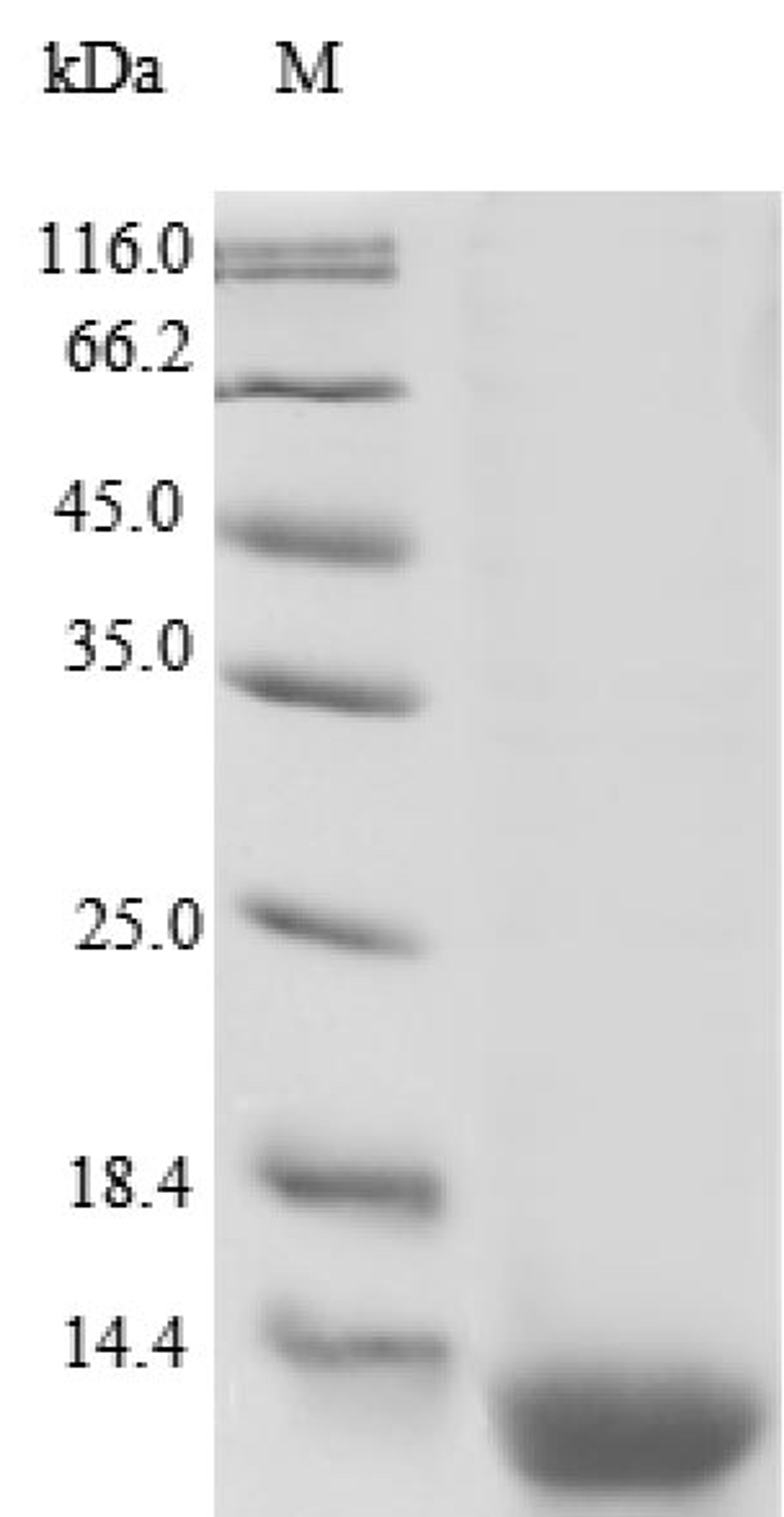 (Tris-Glycine gel) Discontinuous SDS-PAGE (reduced) with 5% enrichment gel and 15% separation gel.