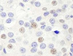 Detection of human GTF3C1/TFIIIC220 by immunohistochemistry.