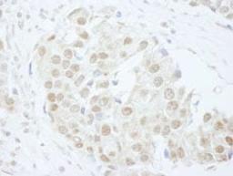 Detection of human PUS1 by immunohistochemistry.