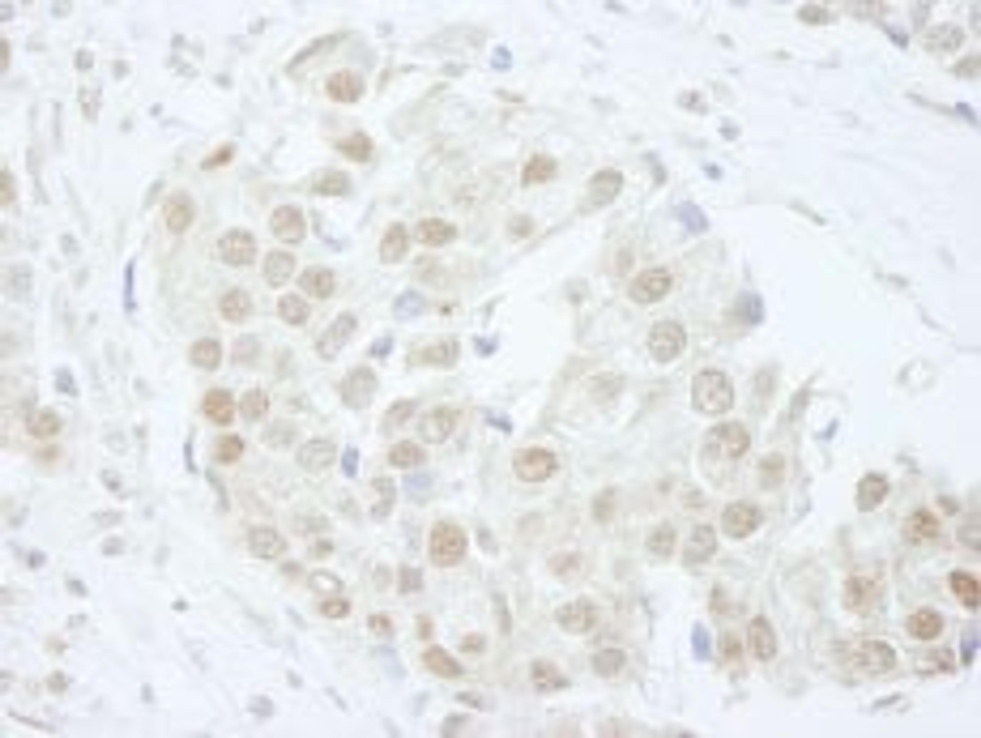 Detection of human PUS1 by immunohistochemistry.