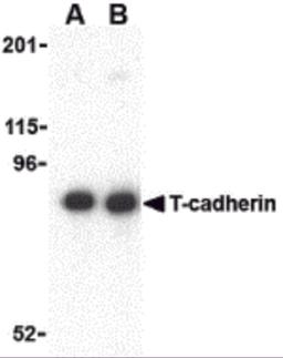 Western blot analysis of T-cadherin in 3T3 lysate with T-cadherin antibody at (A) 0.5 and (B) 1 μg/mL.