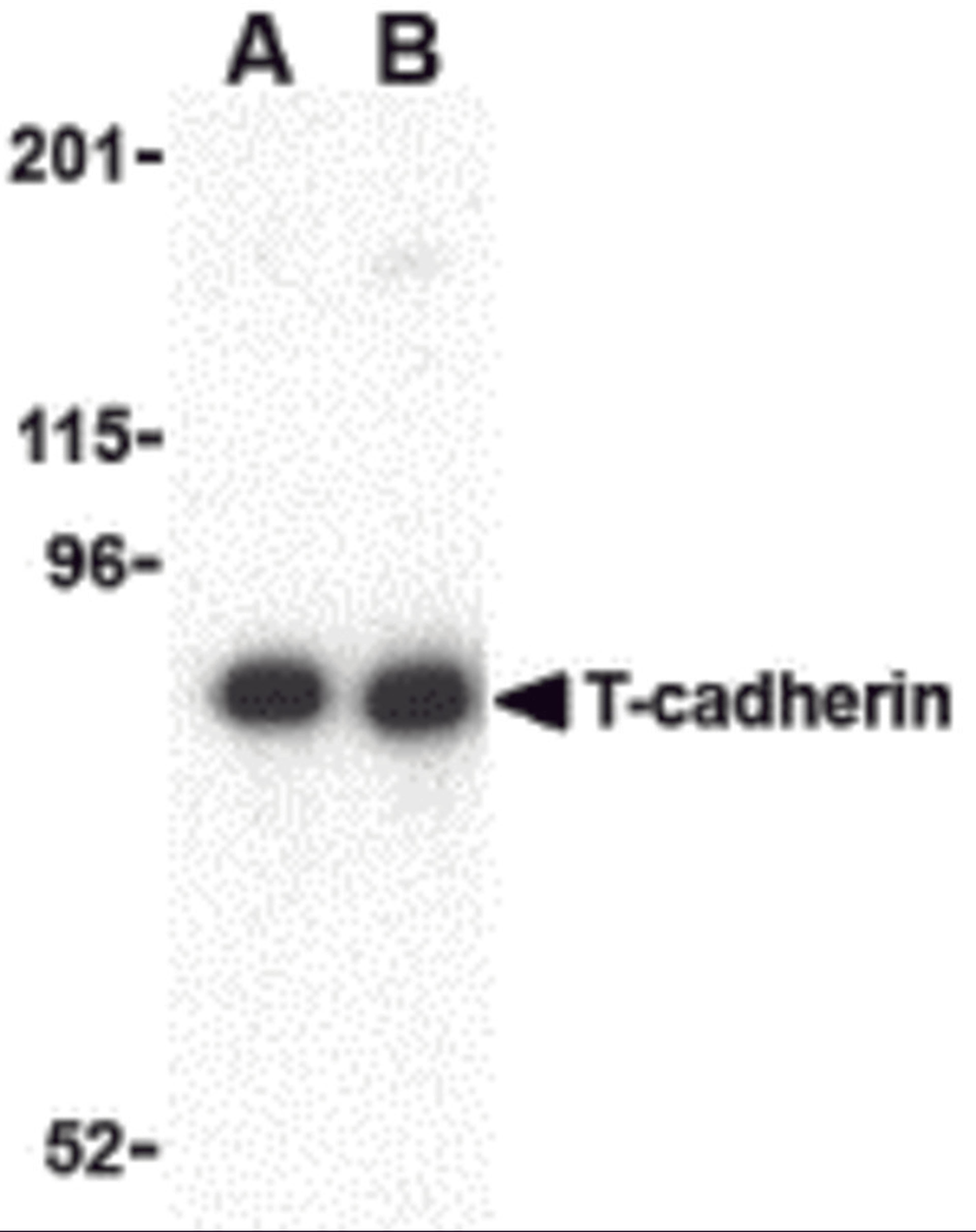 Western blot analysis of T-cadherin in 3T3 lysate with T-cadherin antibody at (A) 0.5 and (B) 1 μg/mL.