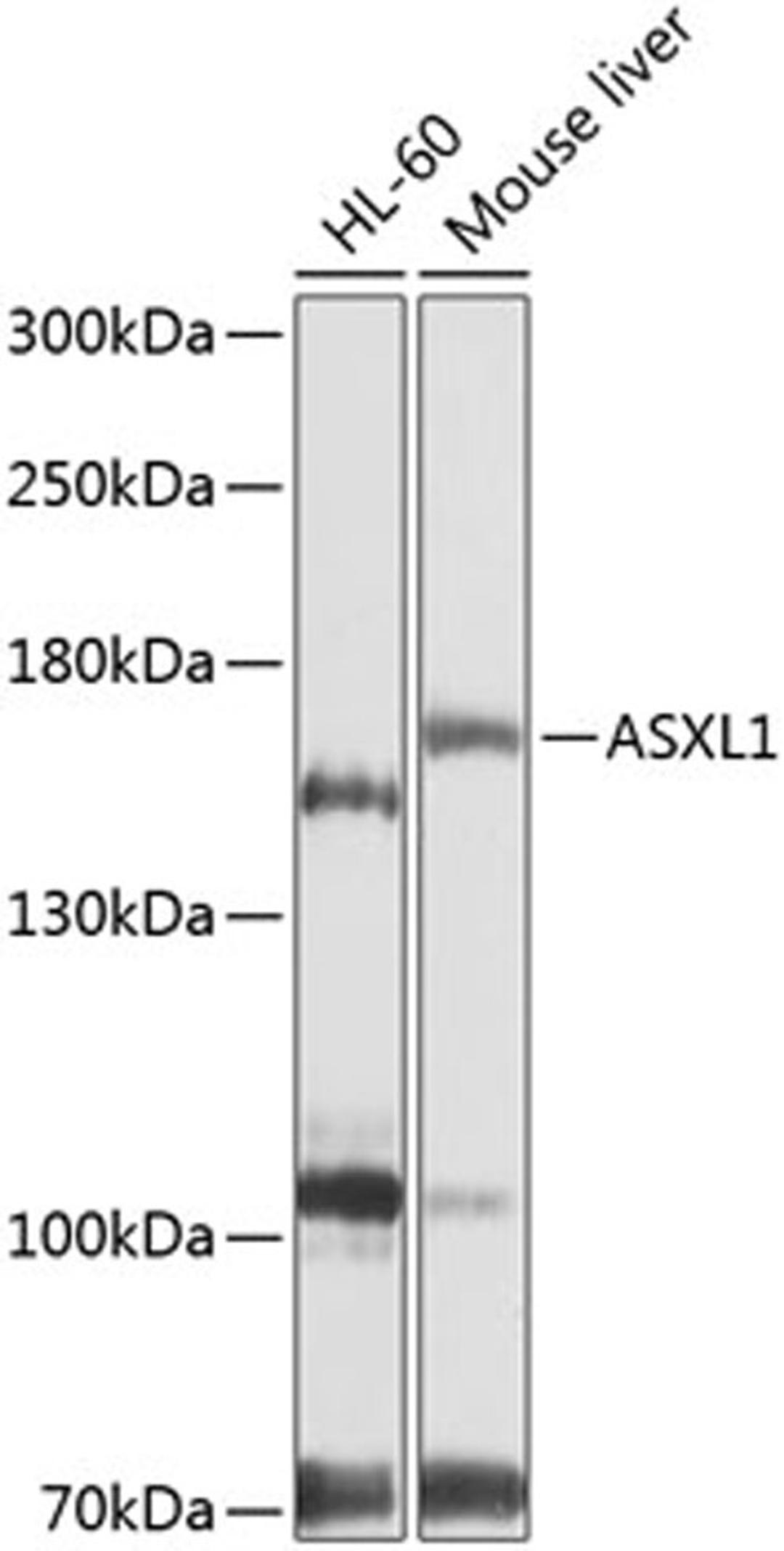 Western blot - ASXL1 antibody (A9890)