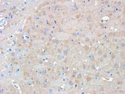 Immunohistochemical staining of paraffin embedded rat brain tissue using CHRNA7 antibody (primary antibody at 1:200)