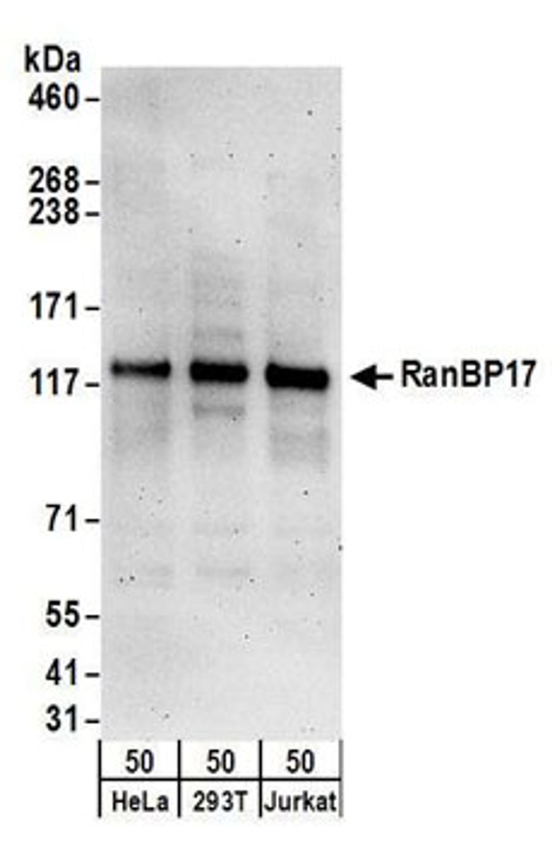 Detection of human RanBP17 by western blot.