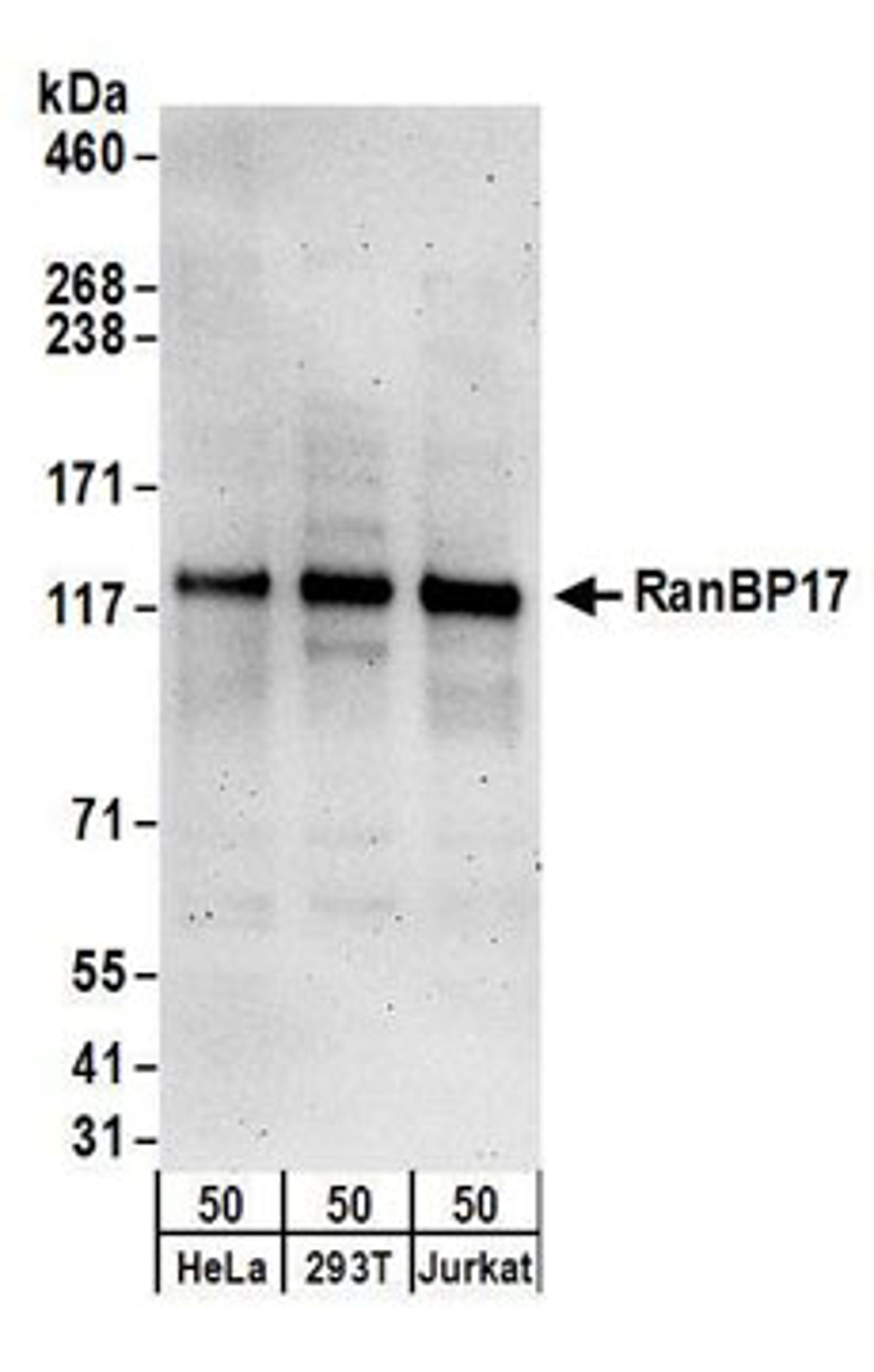 Detection of human RanBP17 by western blot.