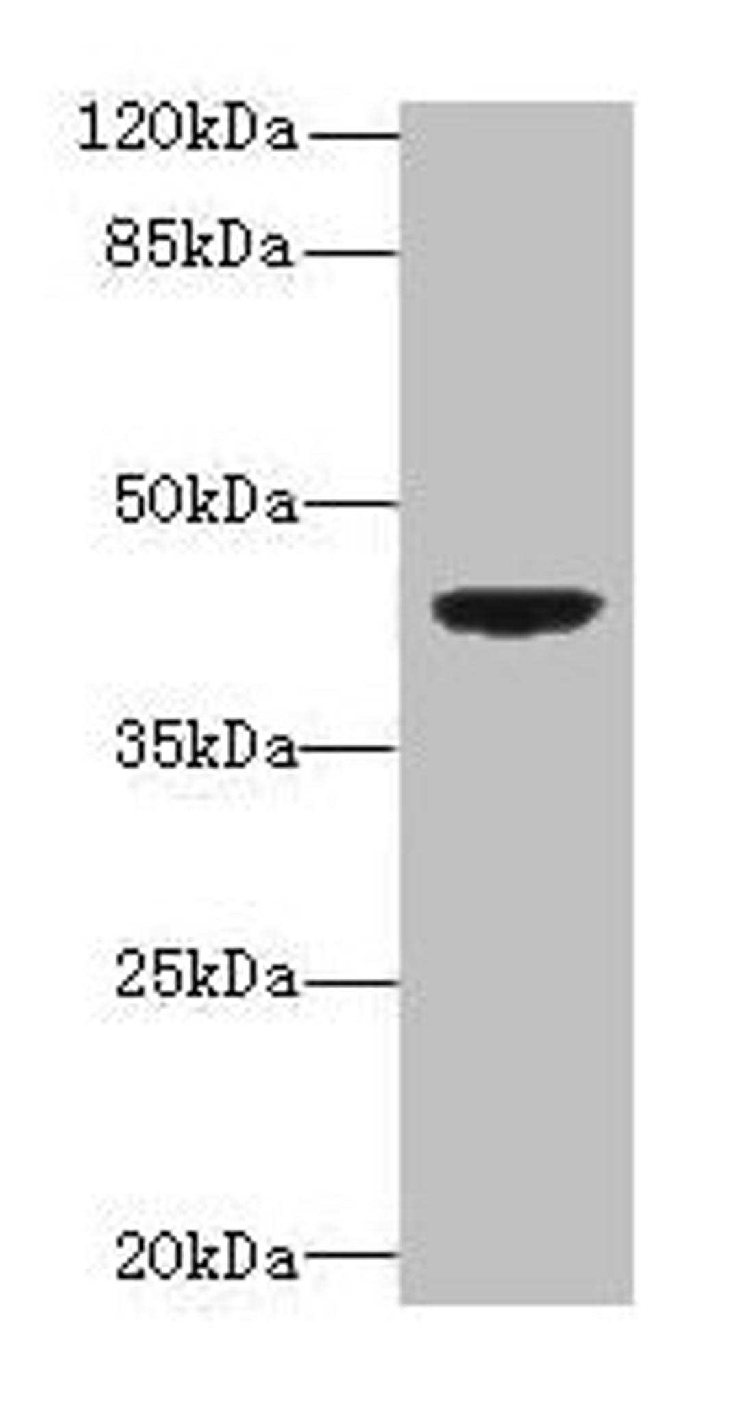 Western blot. All lanes: DAPK2 antibody at 6µg/ml + Mouse brain tissue. Secondary. Goat polyclonal to rabbit IgG at 1/10000 dilution. Predicted band size: 43, 56 kDa. Observed band size: 43 kDa