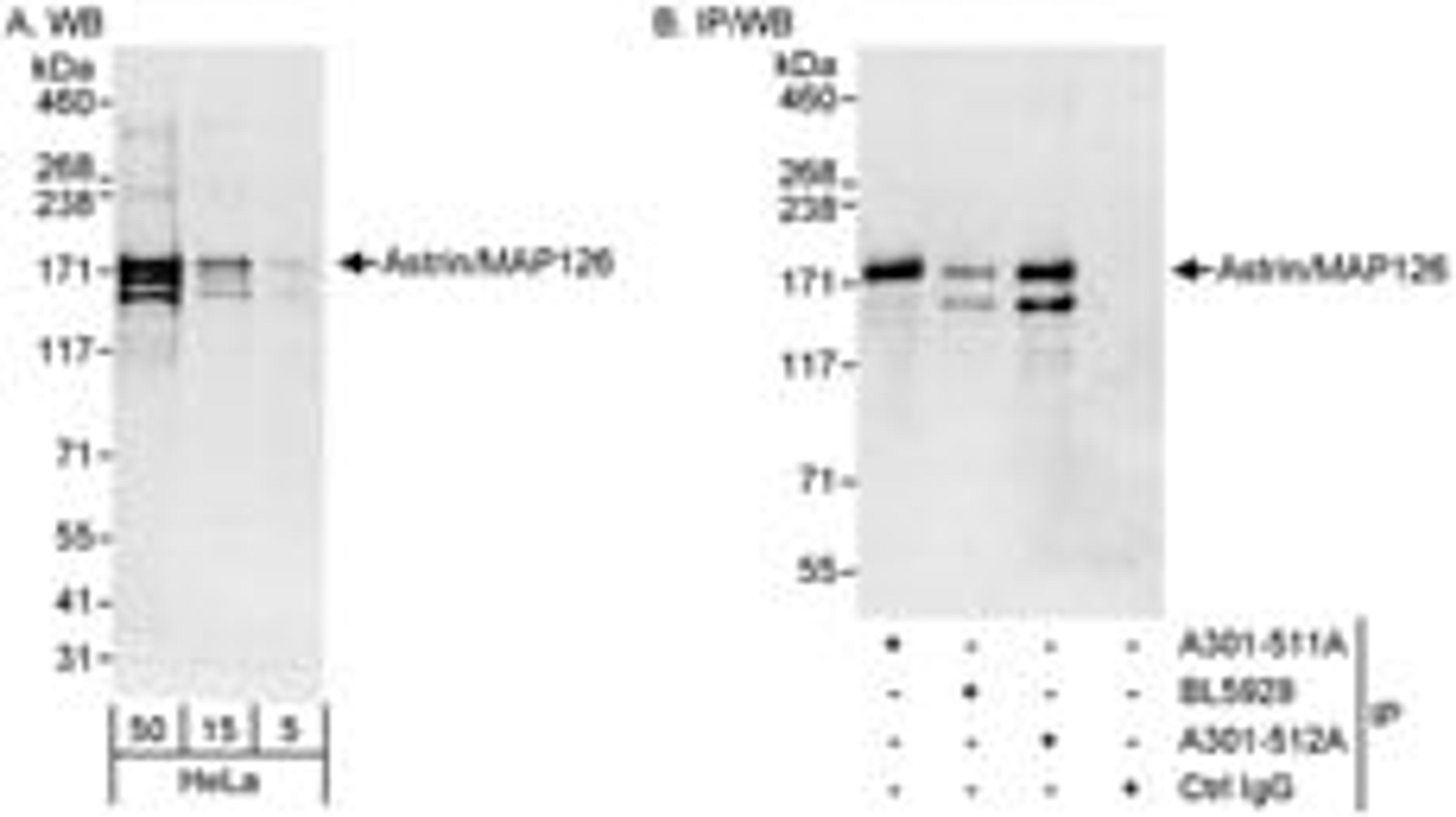 Detection of human Astrin/MAP126 by western blot and immunoprecipitation.