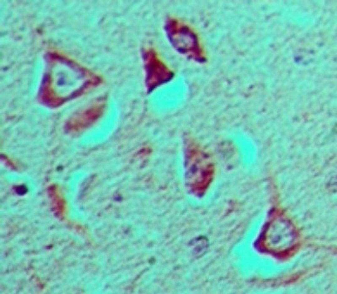 Immunohistochemistry-Paraffin: GFI1 Antibody [NBP2-27173] - Analysis of Gfi-1 in formalin-fixed, paraffin-embedded human brain tissue using this antibody at 5 ug/ml.