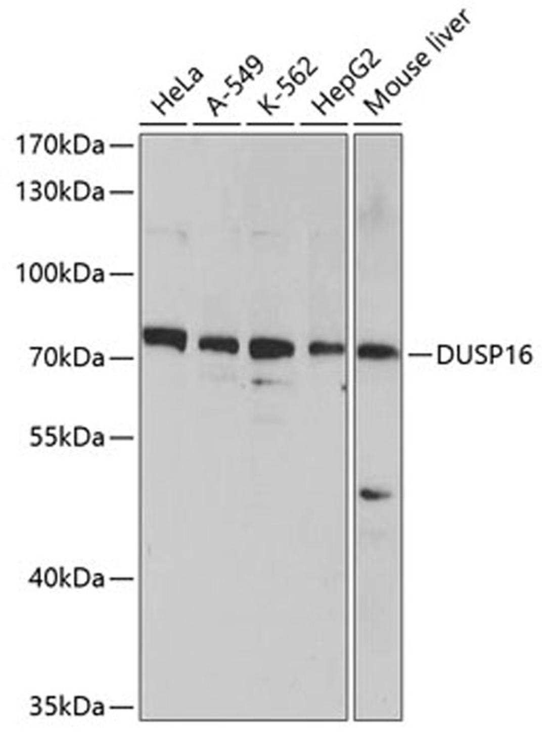 Western blot - DUSP16 antibody (A10155)