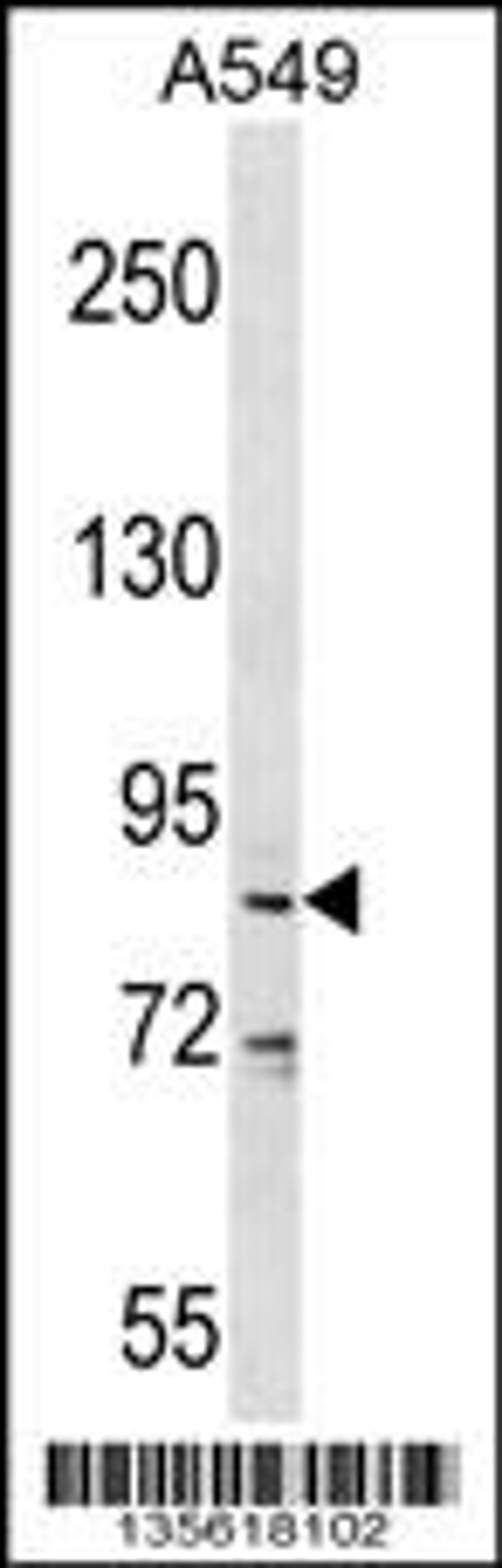 Western blot analysis in A549 cell line lysates (35ug/lane).