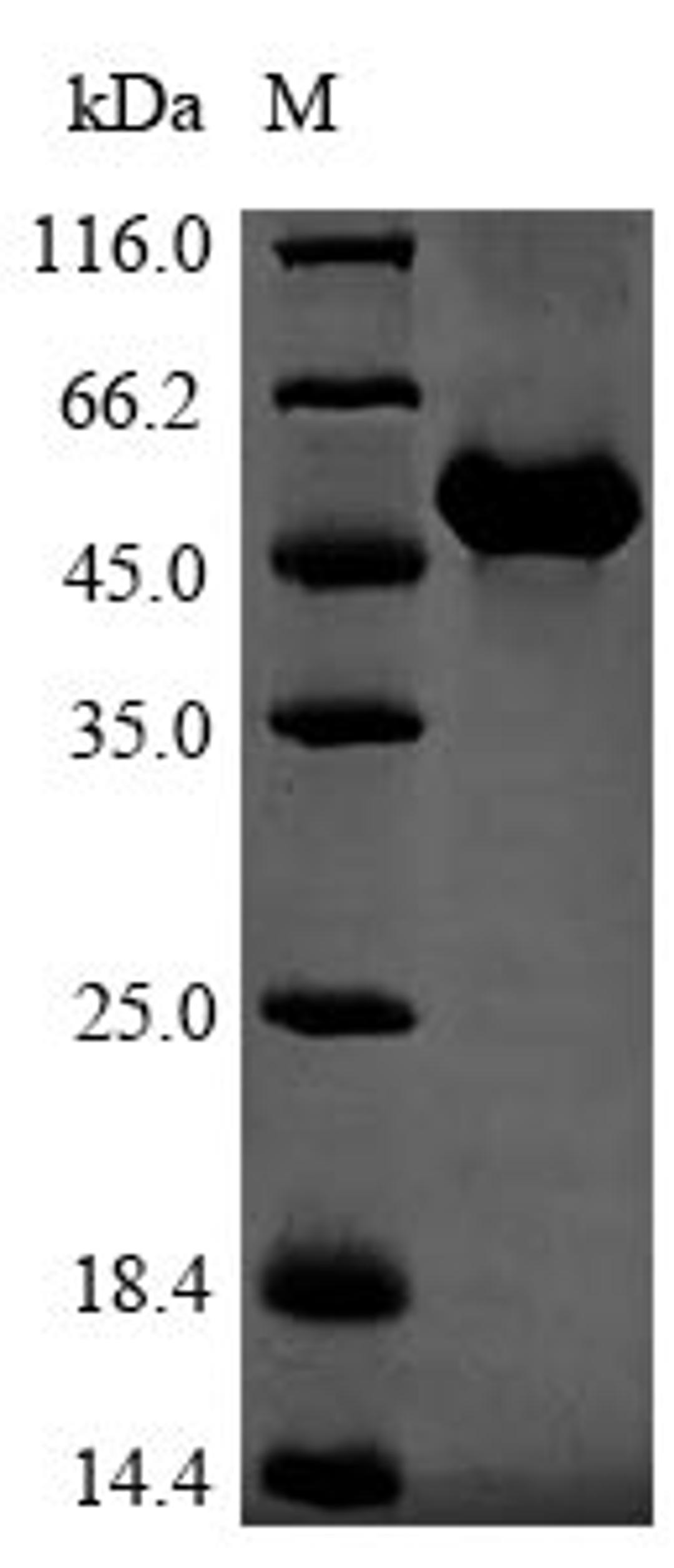 (Tris-Glycine gel) Discontinuous SDS-PAGE (reduced) with 5% enrichment gel and 15% separation gel.