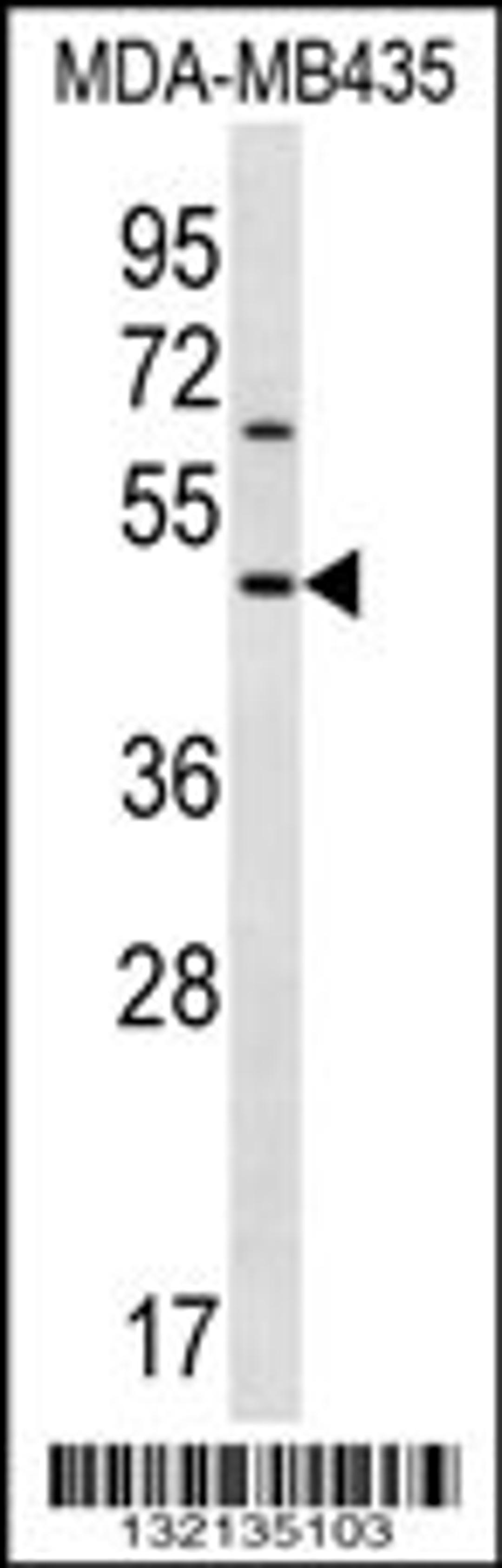 Western blot analysis in MDA-MB435 cell line lysates (35ug/lane).