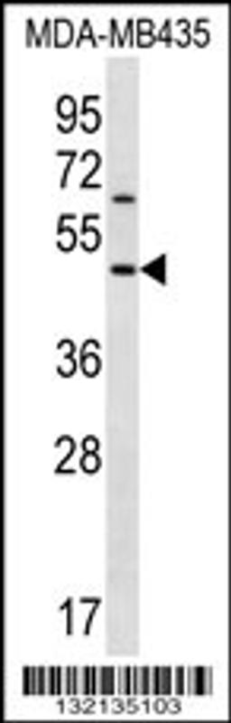 Western blot analysis in MDA-MB435 cell line lysates (35ug/lane).