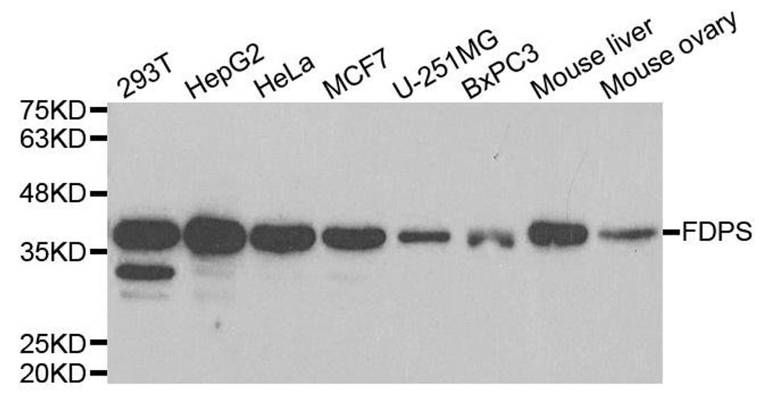 Western blot analysis of extracts of various cell lines using FDPS antibody