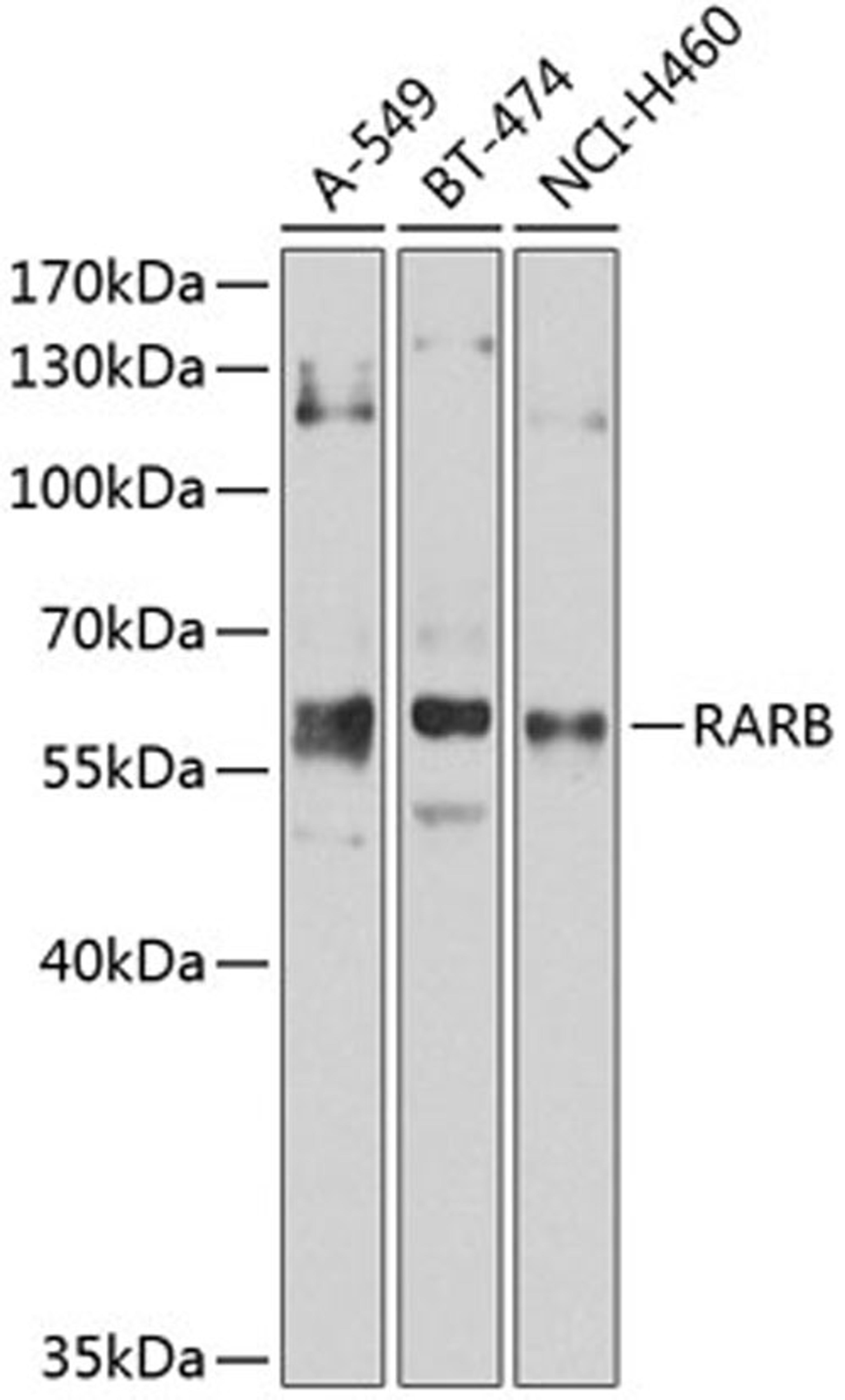 Western blot - RARB Antibody (A1603)