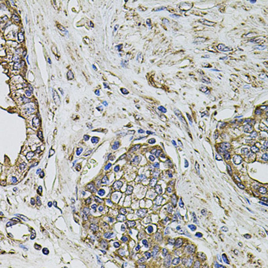 Immunohistochemistry - PTHLH antibody (A12492)