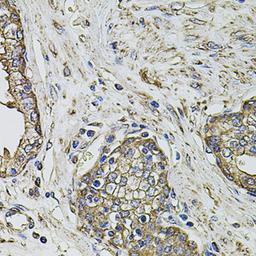 Immunohistochemistry - PTHLH antibody (A12492)