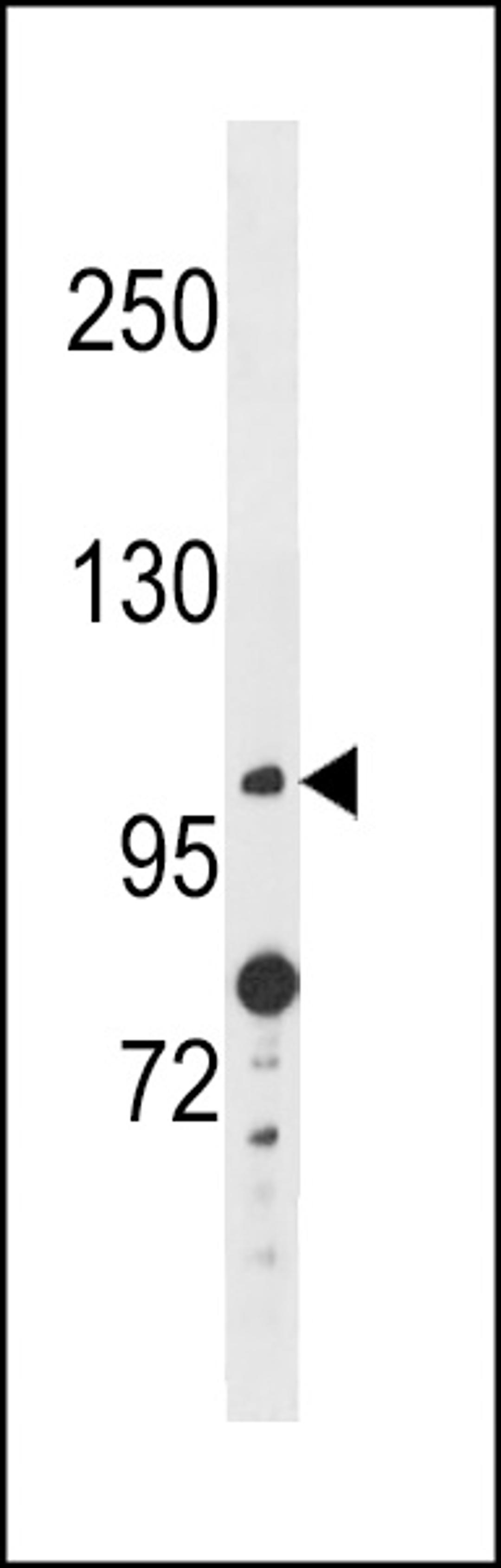 Western blot analysis in A2058 cell line lysates (35ug/lane).