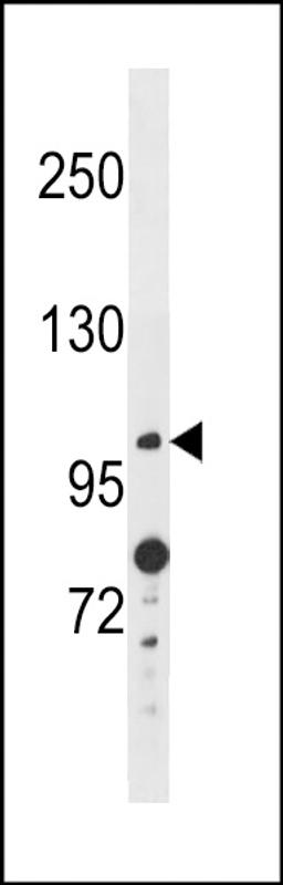 Western blot analysis in A2058 cell line lysates (35ug/lane).