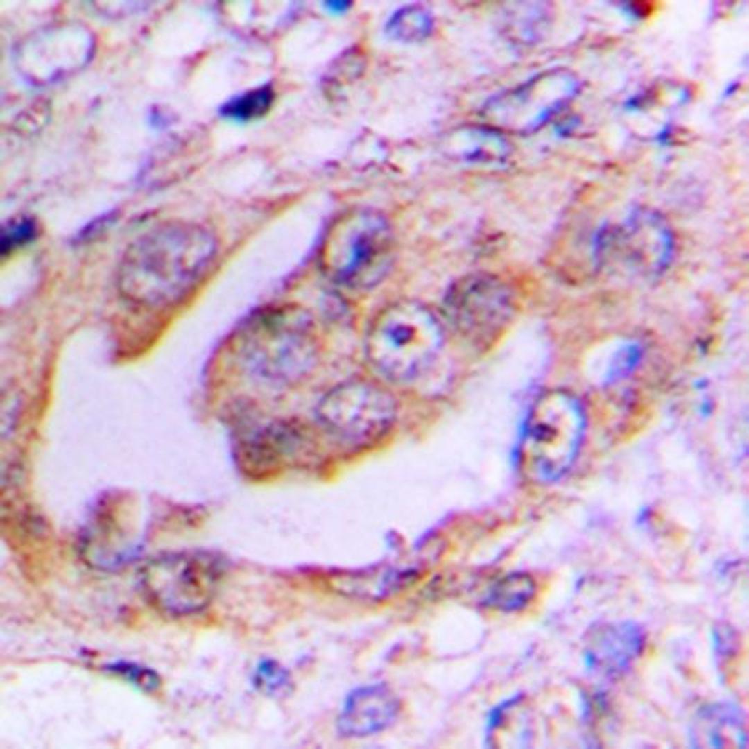 Immunohistochemical analysis of formalin-fixed and paraffin-embedded human lung cancer tissue using EG5 (phospho-T926) antibody