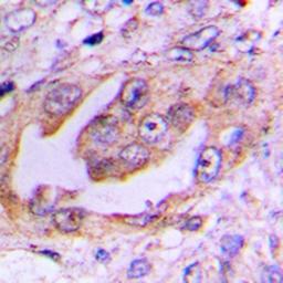 Immunohistochemical analysis of formalin-fixed and paraffin-embedded human lung cancer tissue using EG5 (phospho-T926) antibody