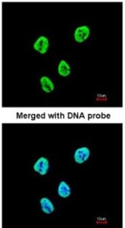 Immunocytochemistry/Immunofluorescence: SET Antibody [NBP1-30888] - Paraformaldehyde-fixed HeLa, using antibody at 1:200 dilution.