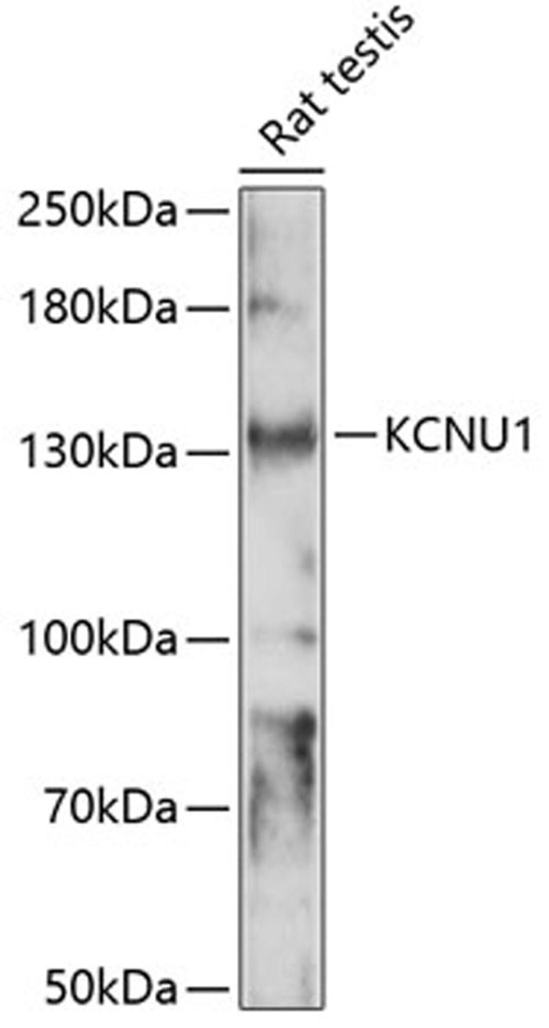 Western blot - KCNU1 antibody (A14967)