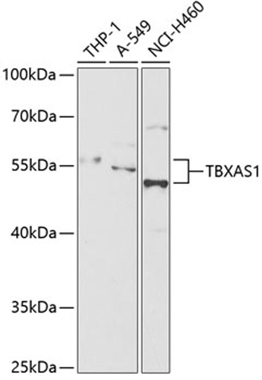 Western blot - TBXAS1 antibody (A13362)