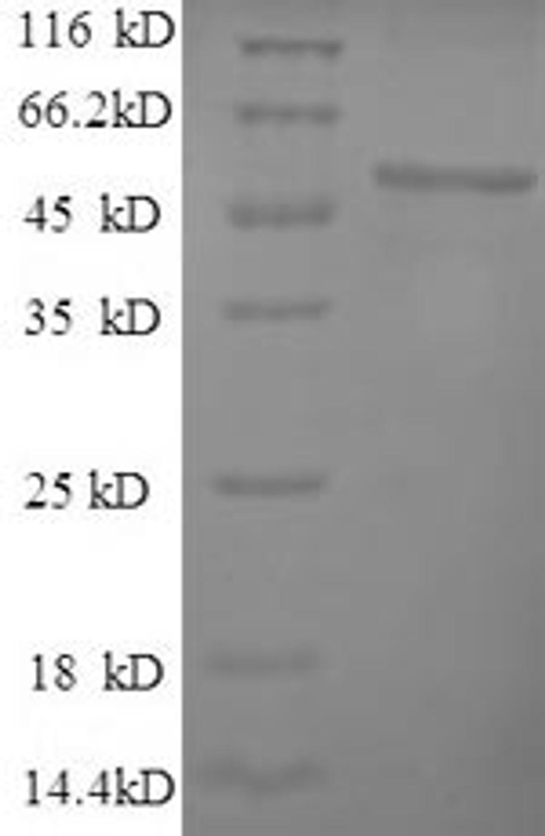 (Tris-Glycine gel) Discontinuous SDS-PAGE (reduced) with 5% enrichment gel and 15% separation gel.