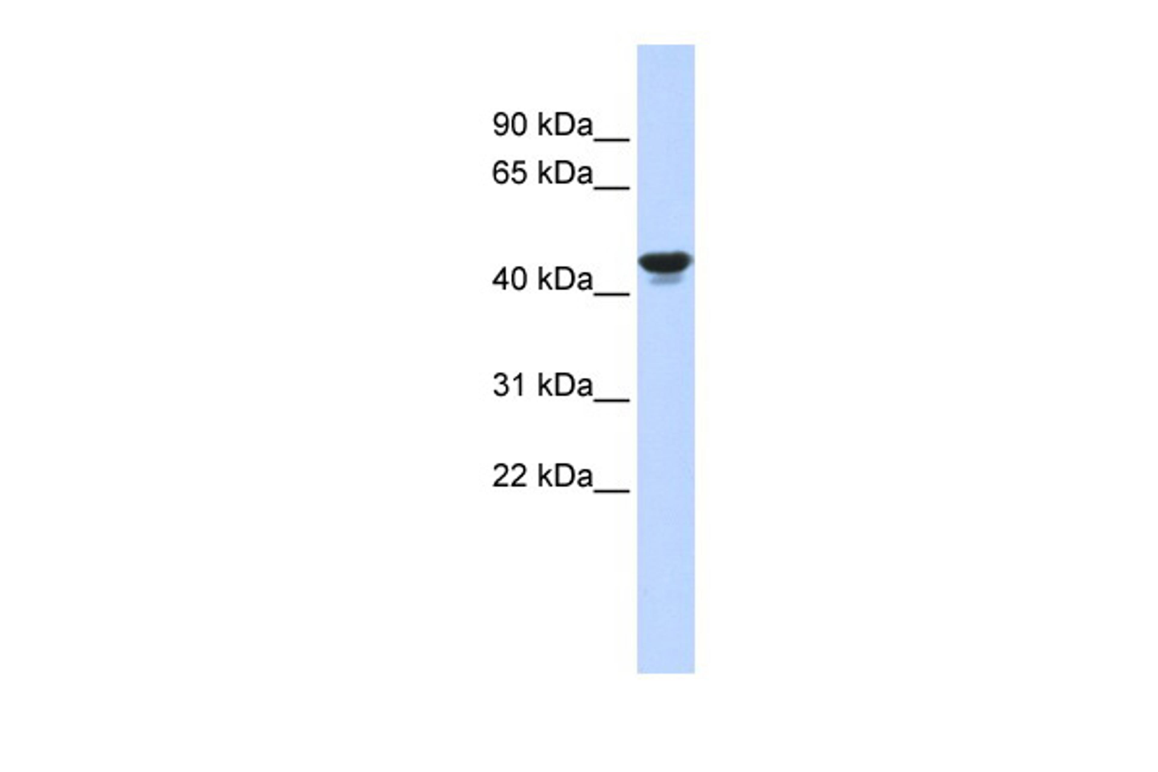 Antibody used in WB on Human Muscle at 0.2-1 ug/ml.