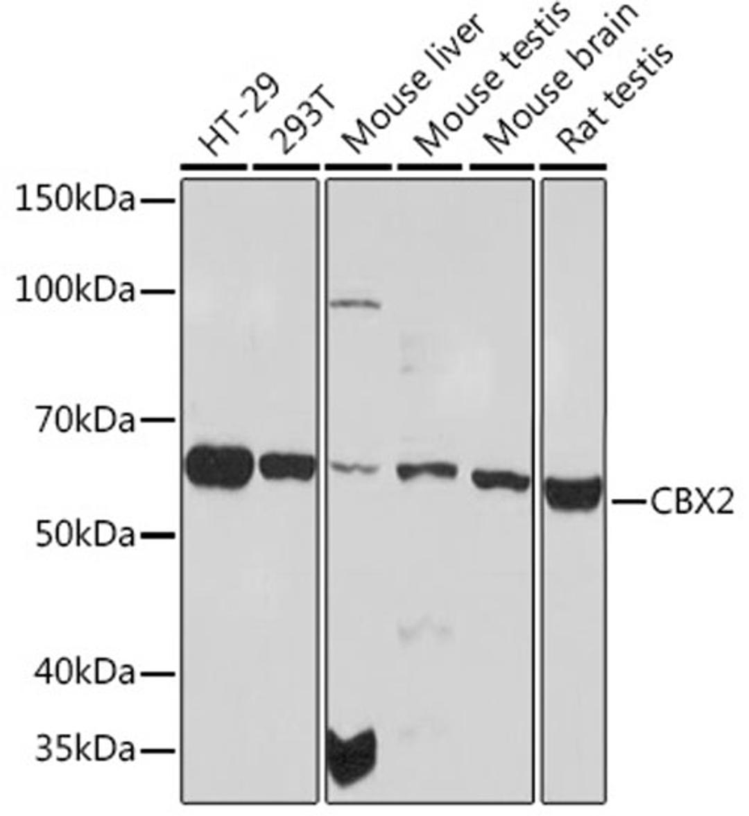 Western blot - CBX2 Rabbit mAb (A3294)