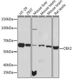 Western blot - CBX2 Rabbit mAb (A3294)