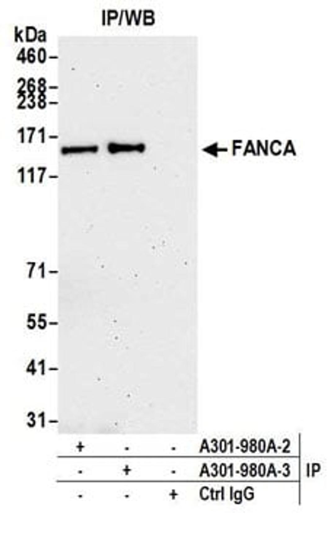 Detection of human FANCA by western blot of immunoprecipitates.